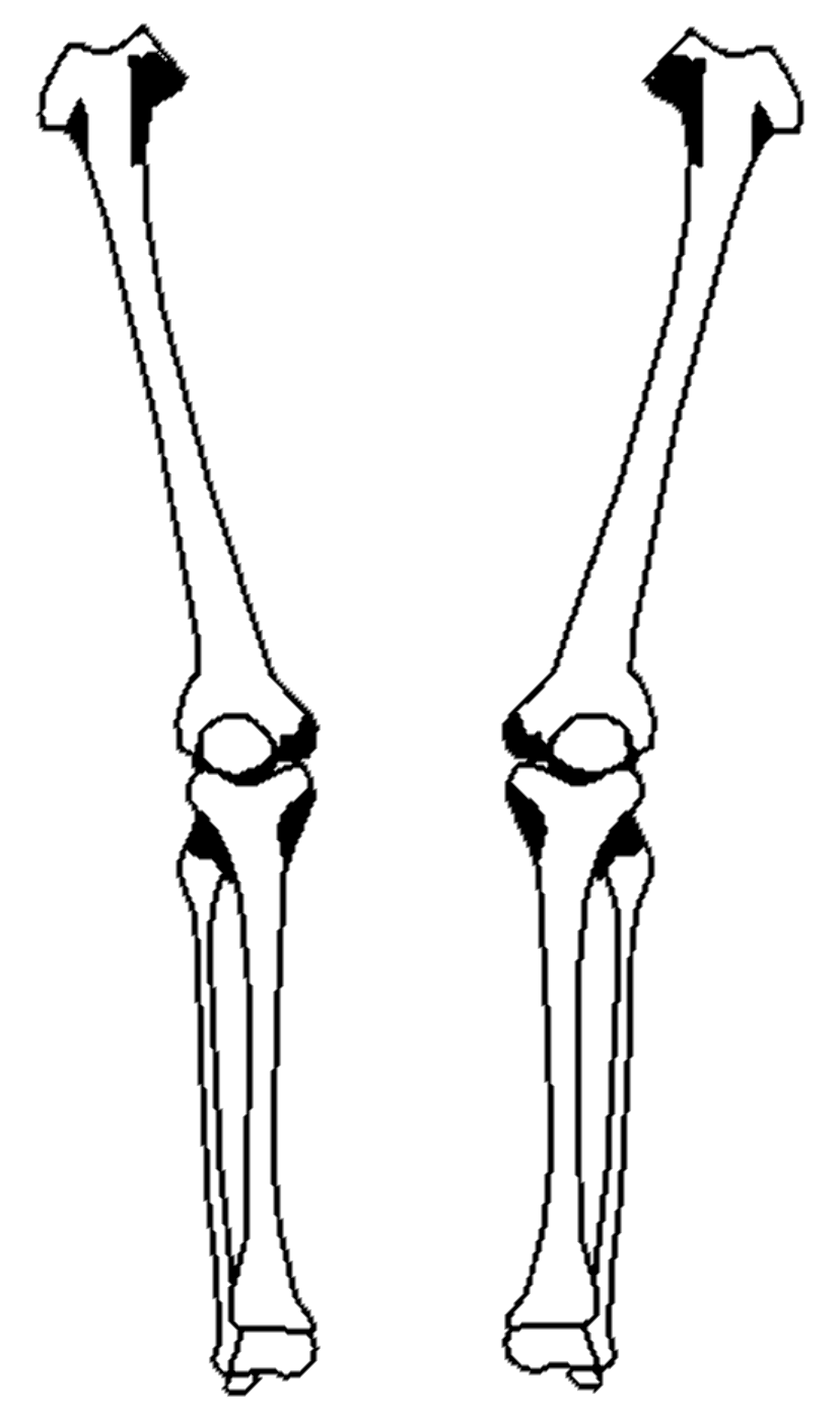 Download High Quality arm clipart skeleton Transparent PNG Images - Art
