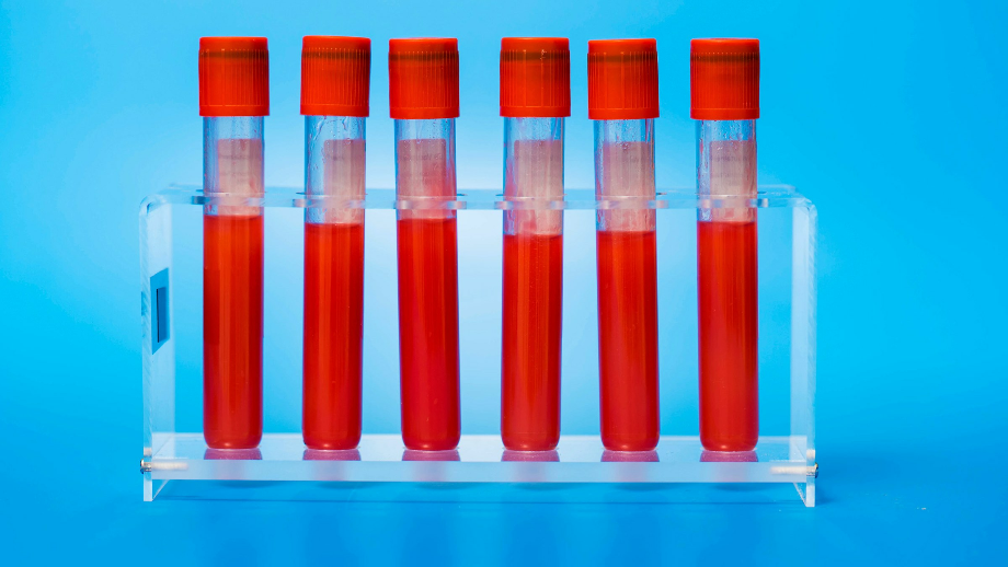 blood transparent science