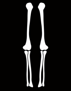 Free Skeleton Arm, Download Free Clip Art, Free Clip Art on ...