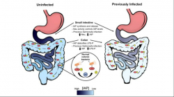 Gut reaction: Repeated food poisoning triggers chronic ...