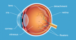Eye floaters and flashes: When is it an emergency? | All ...