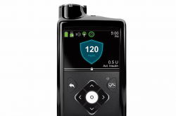 Medtronic\'s MiniMed® 670G Review | World\'s First \