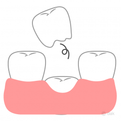 Free Baby Tooth Falling out Clipart Image｜Illustoon
